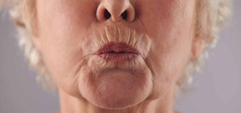 ¿Código de barras? Di adiós a las arrugas del labio 1 codigo de barras di adios a las arrugas del labio