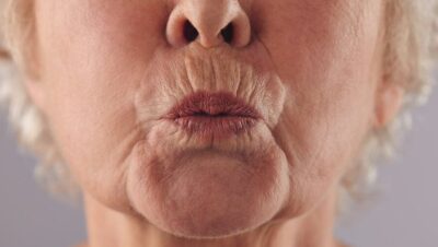 codigo de barras di adios a las arrugas del labio