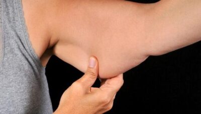combatir la flacidez de brazos y piernas guia completa 1