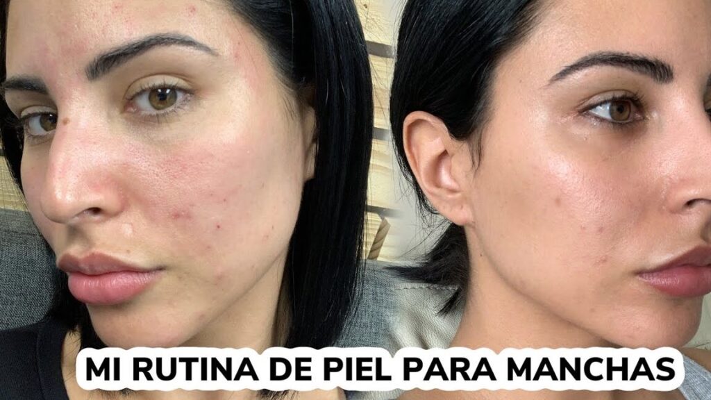 Cómo dejar tu cara lisa y limpia: Consejos efectivos 1 como dejar tu cara lisa y limpia consejos efectivos