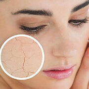 Cómo identificar si necesitas una limpieza facial urgente 1 como identificar si necesitas una limpieza facial urgente