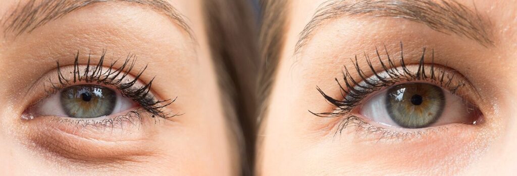 El Beneficio de Usar una Crema Antiojeras 2 el beneficio de usar una crema antiojeras 1