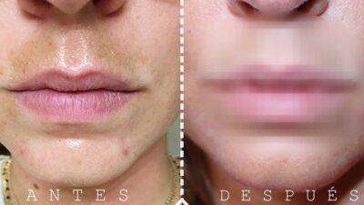 manchas en el bigote por que a mi