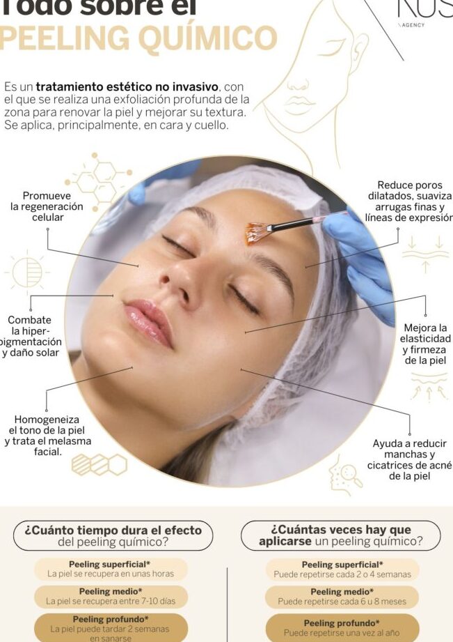 peeling quimico todo lo que necesitas saber 1