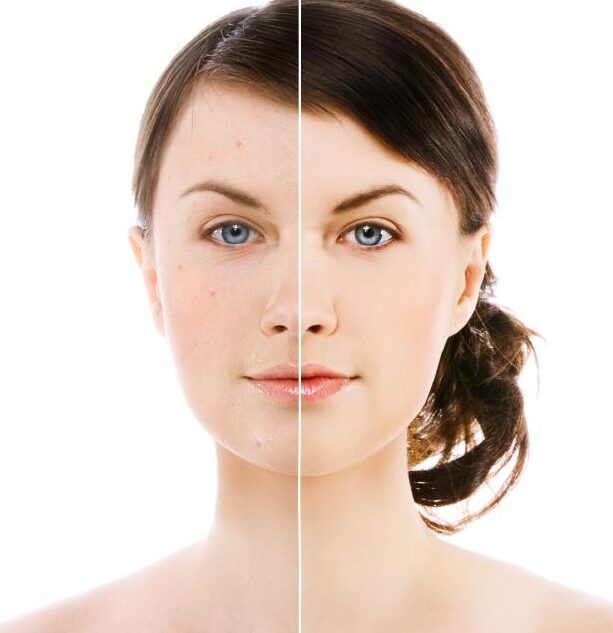 Trucos para una cara limpia y sin manchas: ¡Luce perfecta! 1 trucos para una cara limpia y sin manchas luce perfecta